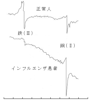 图5 健康人和流感患者的信号