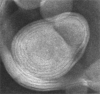 脂质体负染色法（TEM图像）