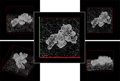 油墨提取复制法（TEM 图像）