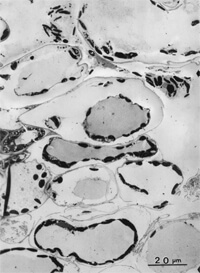 菠菜加压冷冻法（EM-PACT）