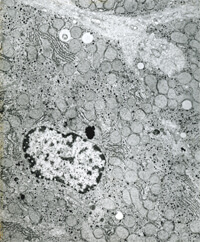 肝脏（小鼠）化学固定+浸泡法