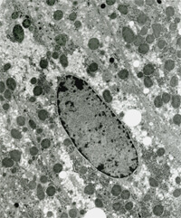肝脏（小鼠）压力冷冻法