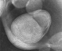 脂质体负染色法（TEM图像）