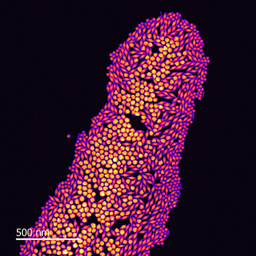 图2 金双锥纳米晶的STEM环形暗场图像
