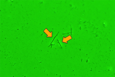 相差显微镜 (PCM) 照片