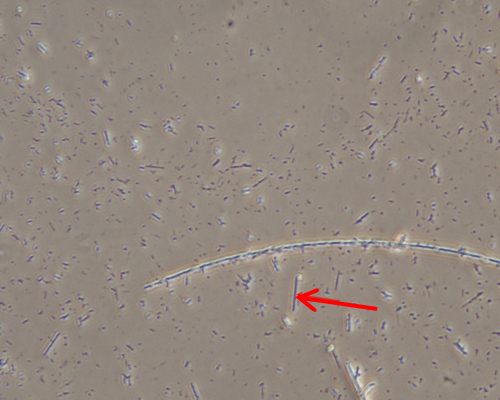 图3 LM相差图像放大