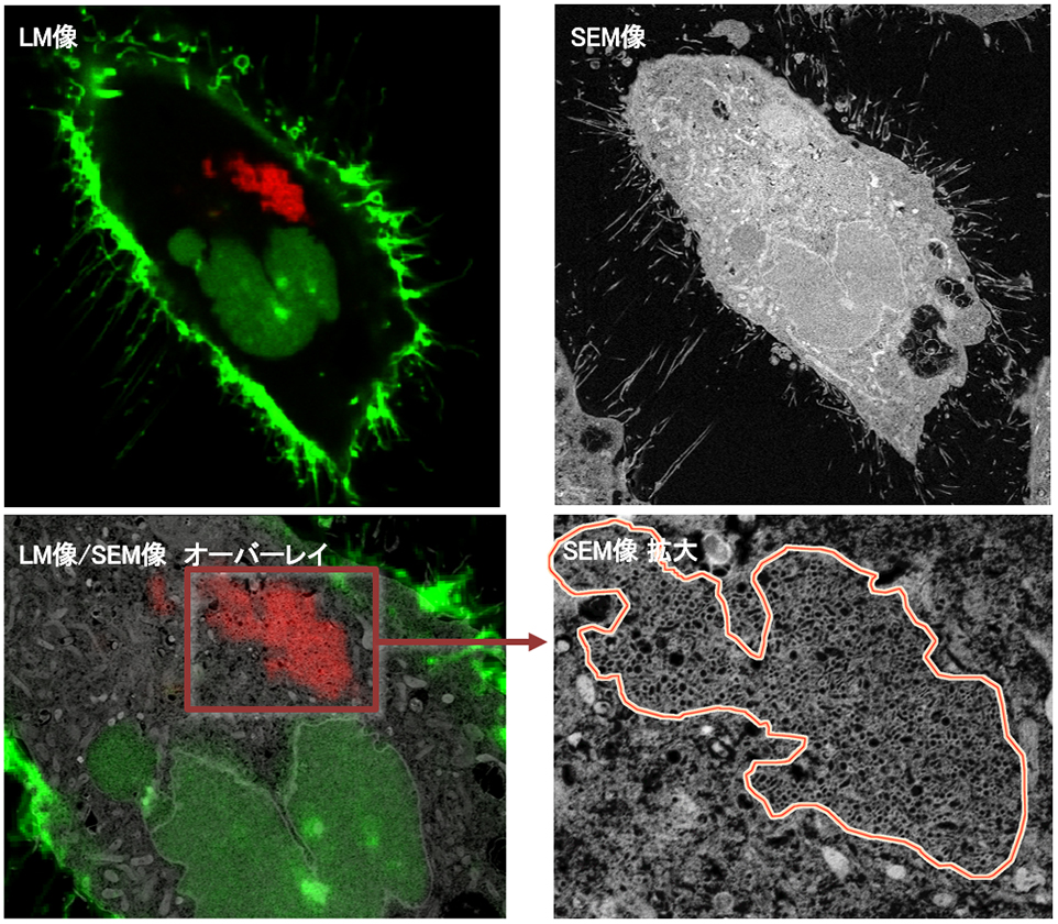 HeLa 细胞中内体的观察 1
