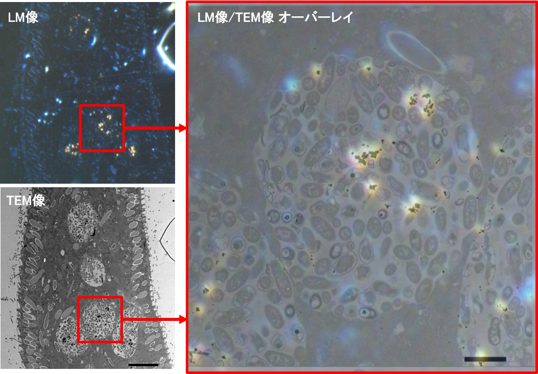 样品：草履虫 TEM 图像/LEM 图像