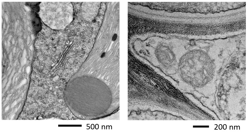 超薄切片样品观察结果